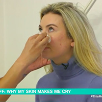 Fight acne like Toff - tips from This Morning’s Dr Anjali Mahto